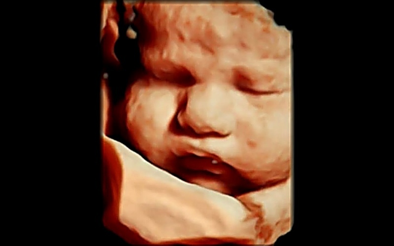 Ultrasonido fetal 3D y 4D de tercer trimestre — valoración anatómica y bienestar del bebé en Guadalajara
