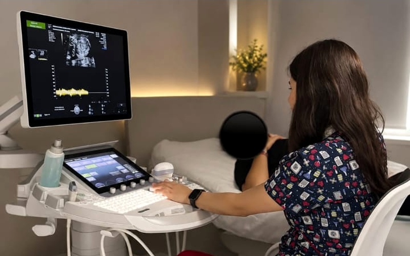 Dra. Odette Noyola realizando ultrasonido estructural fetal de alta definición con ecógrafo GE Voluson en Guadalajara